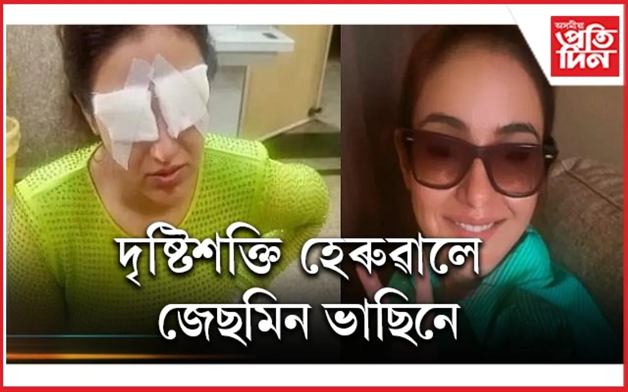 ‘কণ্টেক্ট লেন্স’ ব্যৱহাৰ কৰাসকল সাৱধান হওঁক